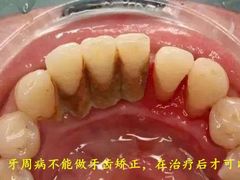 -团圆口腔·种植中心(锦江院区)