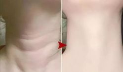 -海涛医疗美容·面部抗衰·注射美鼻