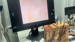 -悟空祛痘·诺奖技术专业店