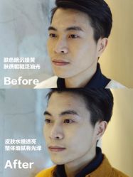 -美壹生诊所皮肤管理中心·海菲秀&Legacy美白舱