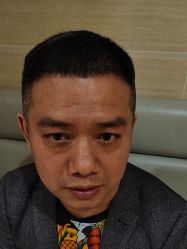 -大麦微针植发丨全国连锁