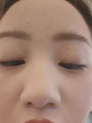-长沙雅美医疗美容医院