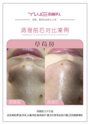 -元熙兰积皮肤管理