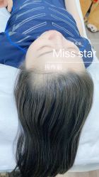 -MISS STAR·半永久纹眉·发际线·美瞳线