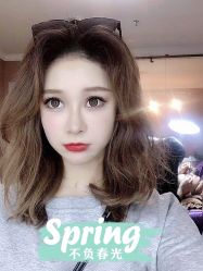 体验后-大麦微针植发全国连锁