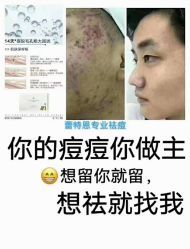 -蕾特恩专业祛痘·皮肤管理