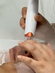 -凡碧诗毛孔清洁收细