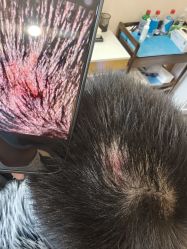 -碧莲盛·不剃发植发