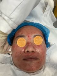 体验前-agge蛋白医美