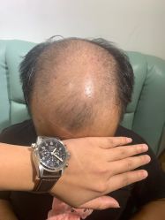 -发饰美男士增发补发假发定制店