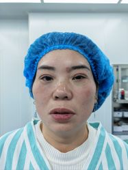 -天津健丽·去眼袋医疗美容机构