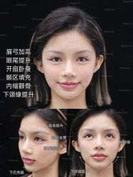 -深圳艺星医疗美容医院