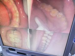 -好牙依口腔(开源店)