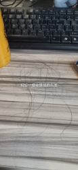 体验后-正璞医疗美容·皮肤修复·微整注射