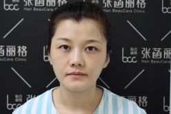 体验前-联合丽格·张菡丽格医疗美容