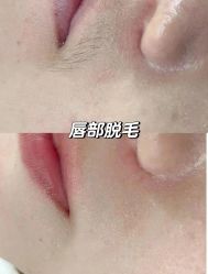 -美愈美肤MEIYU SKIN