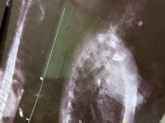 -张钰强中医正骨推拿连锁(华发商都店)