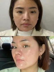 -SKIN79皮肤管理中心