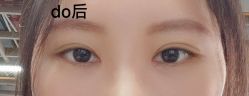 -广州美莱医疗美容医院