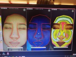 皮肤诊断-光SPA科技美肤