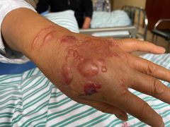 -浙江省立同德医院(翠苑院区)