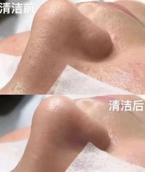 -痘庄科学祛痘国际连锁