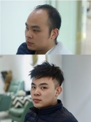 -发饰美男士增发补发假发定制店