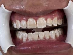 -圣贝口腔(海淀店)