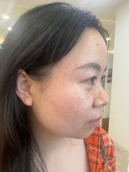 -长沙雅美医疗美容医院