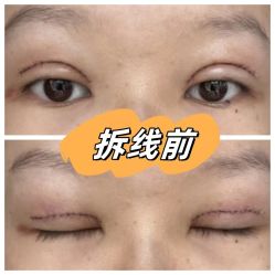 -素美医疗美容·西南眼鼻整形·修复基地