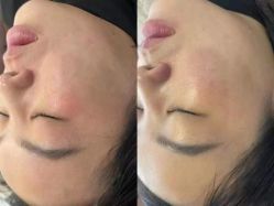 -LUNA皮相美·骨相美高级美感