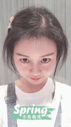 点击看大图 -大麦微针植发全国连锁