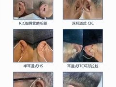 -惠耳听力助听器(霍邱新蓼大道店)