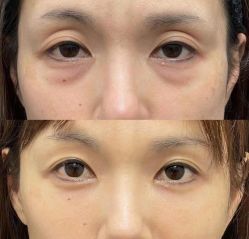 -铂特丽医美·眼鼻整形·光电美肤·注射抗衰