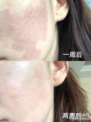 点击看大图 -南京康美美容医院·旗舰店