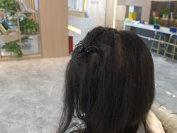 -碧莲盛·不剃发植发