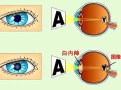 -标准眼镜·蔡司官方授权店(塘沽远洋未来汇店)