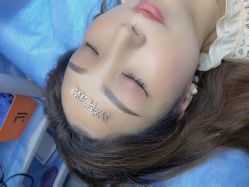 -郡艺医疗美容·微整·眼鼻吸脂