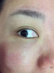 -晶奕空间专业脱毛连锁机构