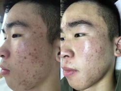 点击看大图 -ROYEA茹彦祛痘·问题肌肤修护中心