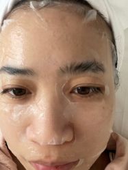 体验后-慕颜医疗美容·皮肤微整 抗衰