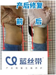 -蓝丝带产后恢复中心(都江堰店)