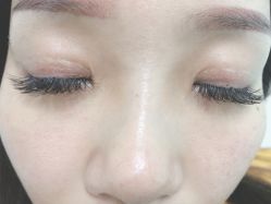 -痣清宫祛斑祛痣连锁店