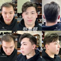 -型男帮男士假发补发·佩戴式发型