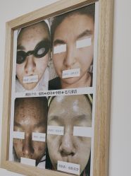 -美肤盾祛痘·问题肌头疗管理中心