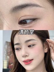 -清颜堂丨分子祛痘·功效美肤