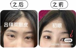 -深圳艺星医疗美容医院