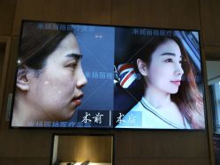 -北京米扬丽格医疗美容·联合丽格鼻整形中心