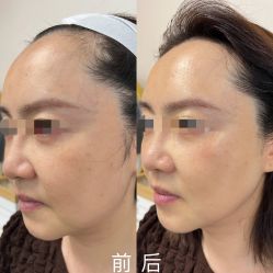 -MUFI·美悦菲塑颜美容SPA