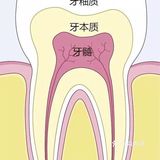 牙齿随着年龄越来越黄 该怎么美白牙齿呢？